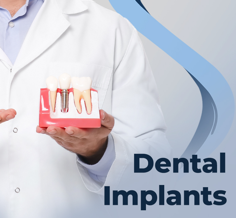 Dental Implant